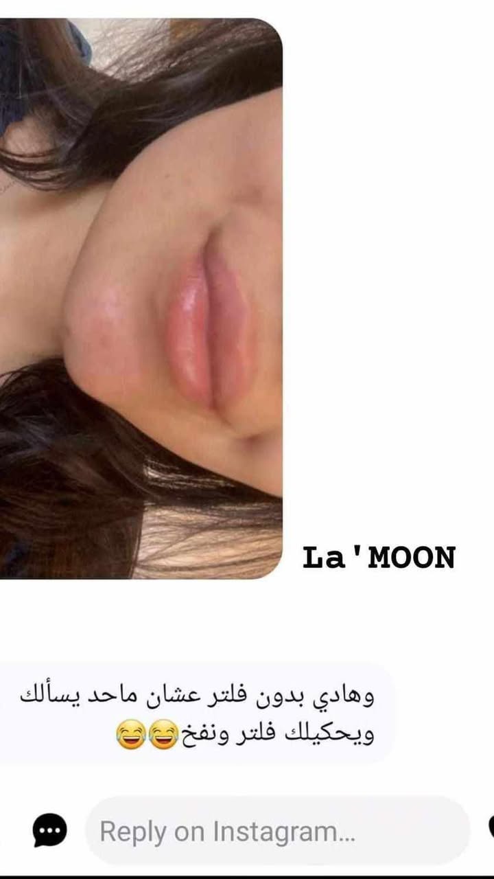 بديل الفيلر للشفاه من لامون - مكبر و مورد La'moon lips