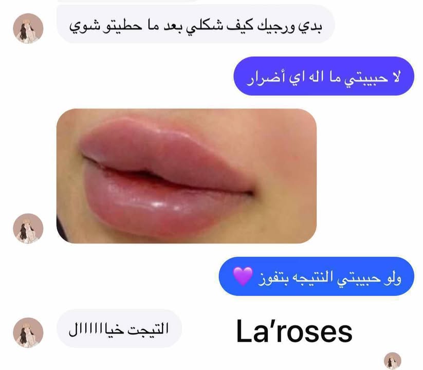 مكبر الشفاه من لاروز